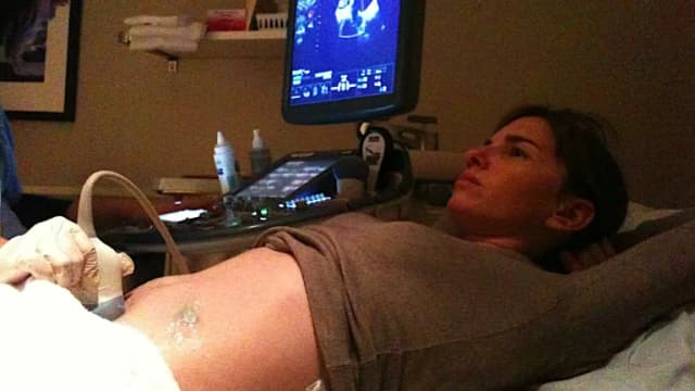A woman receiving an ultrasound examination