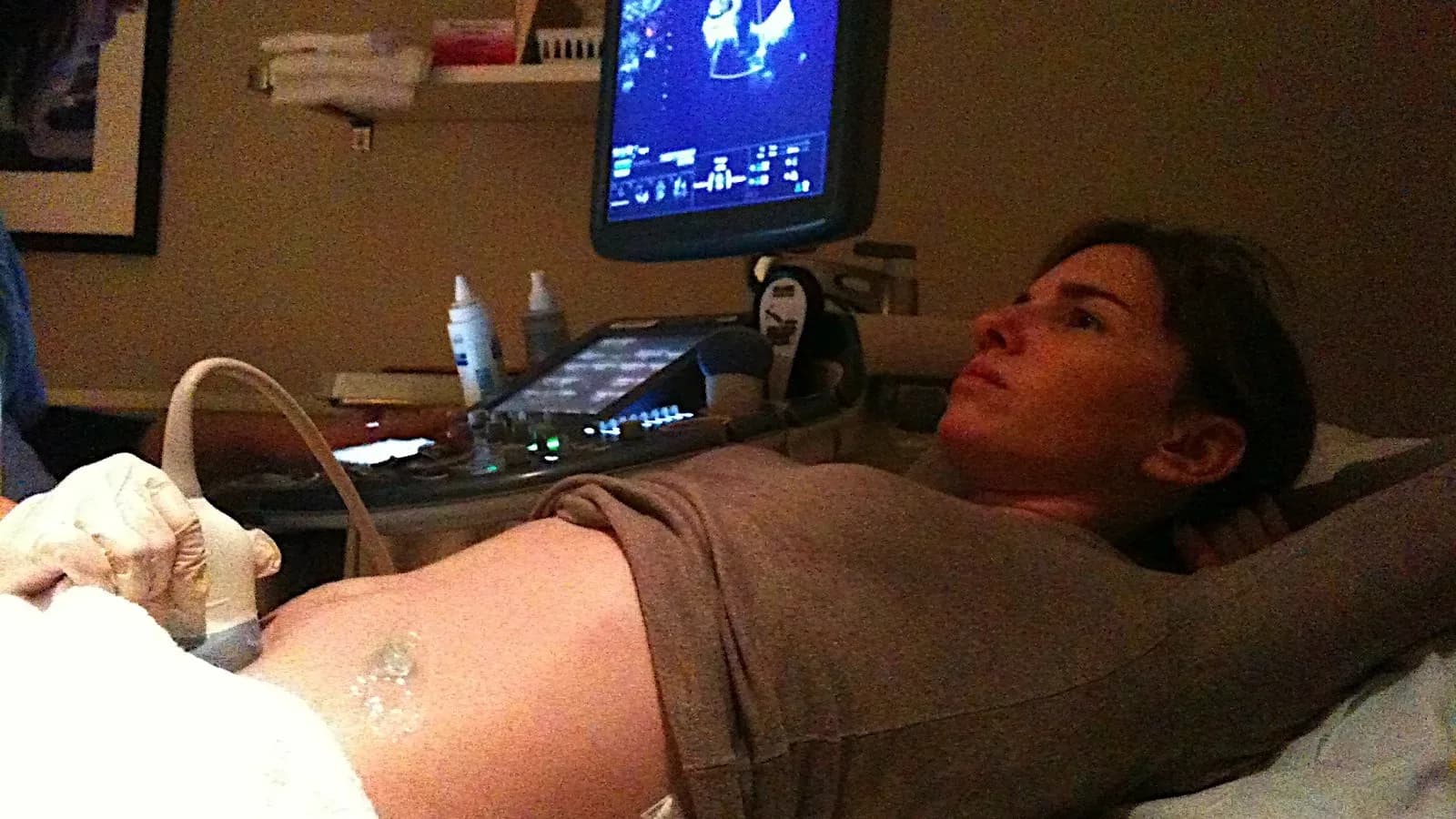 A woman receiving an ultrasound examination