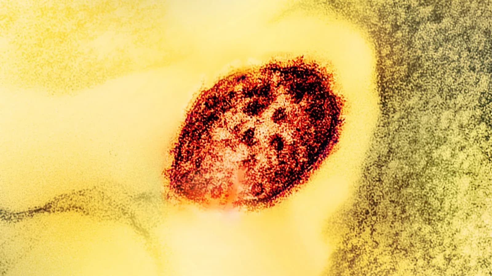 Colorized electron microscope image of a measles virus particle